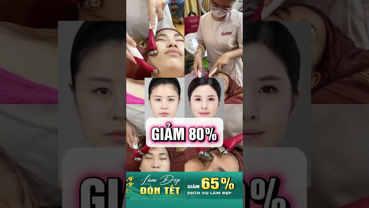 Bí Quyết Làn Da Đẹp Đón Tết| Thẩm Mỹ Viện Hoa Anh 