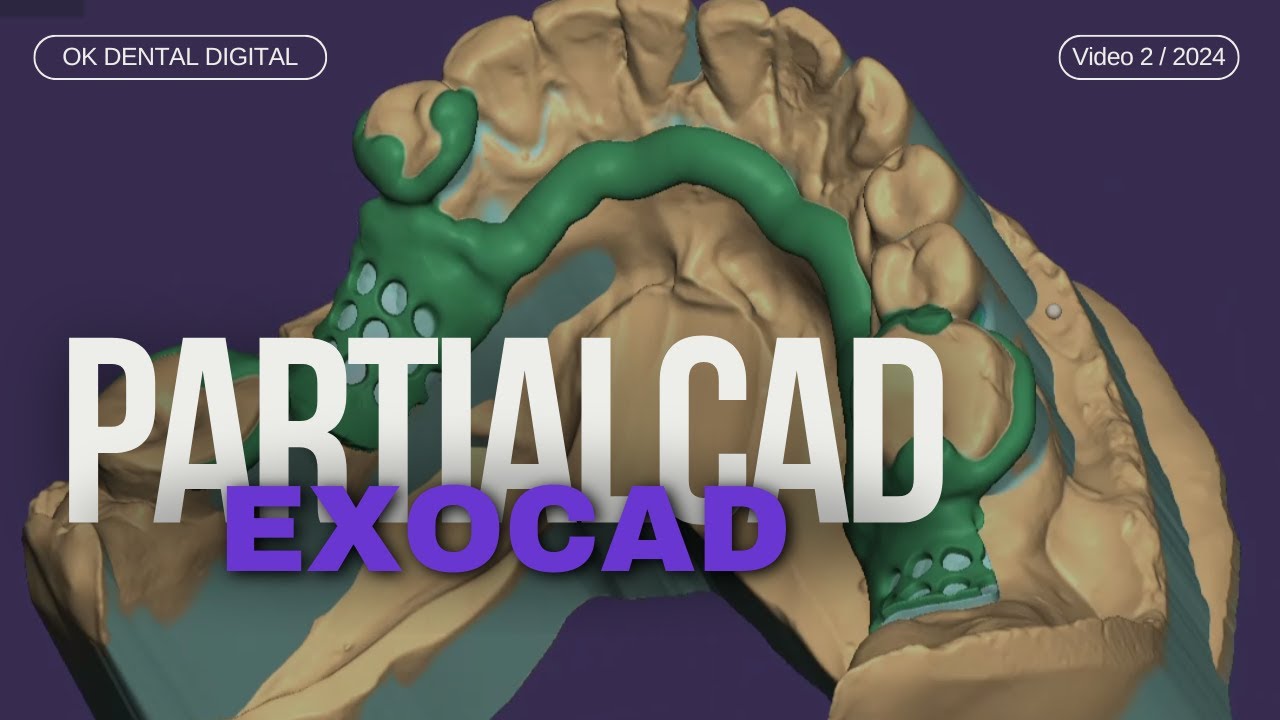 exocad partialcad dise&ntilde;o de estructura inferior / exocad partial lower frame design