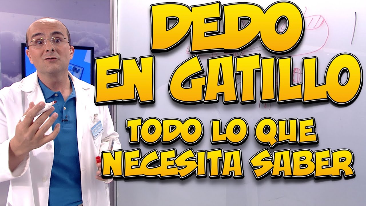 DEDO EN GATILLO - Todo lo que necesita saber