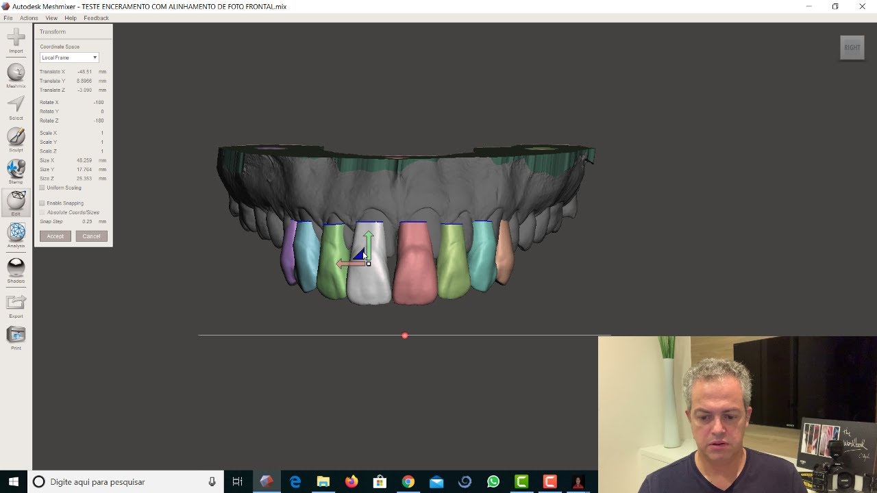 Meshmixer alinhamento da arcada em arquivo stl com a foto de sorriso frontal do paciente