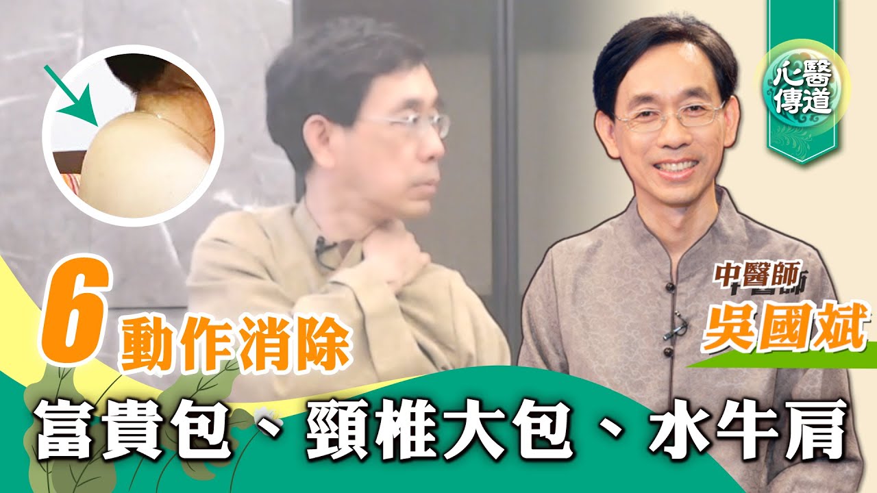 【醫道心傳】手麻 胸悶 肩頸緊繃痠痛 頭暈頭痛 耳鳴 睡眠障礙 眼睛酸澀 都可能由富貴包引起 |吳國斌中醫師 |頸椎大包 水牛肩 保養歸位頸椎 改善駝背 增加進氧量 幫助睡眠 放鬆肩頸按摩|#綠色東方