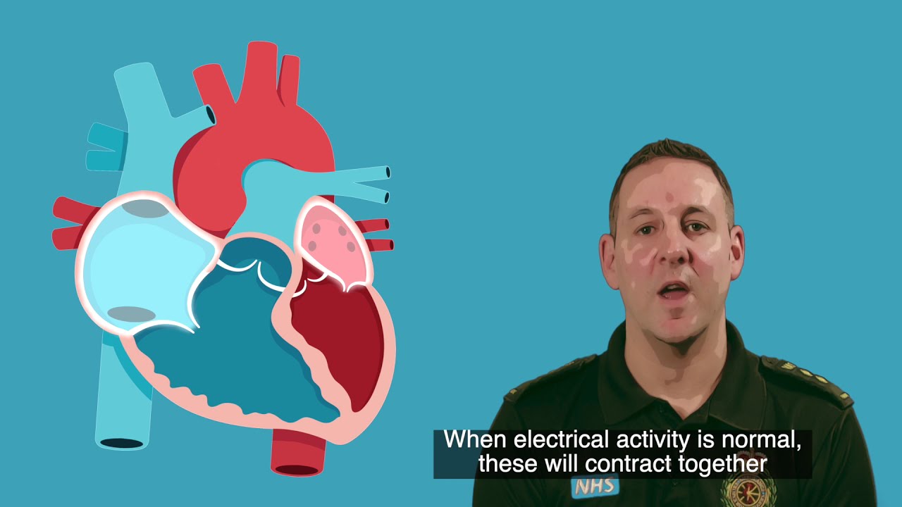 Everything you need to know about life-saving defibrillators