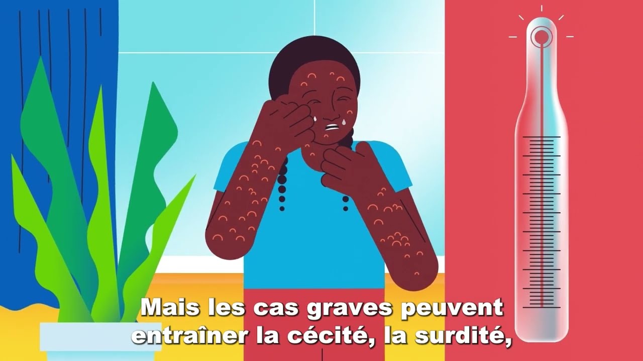 Pourquoi devrais-je me faire vacciner contre la rougeole ?