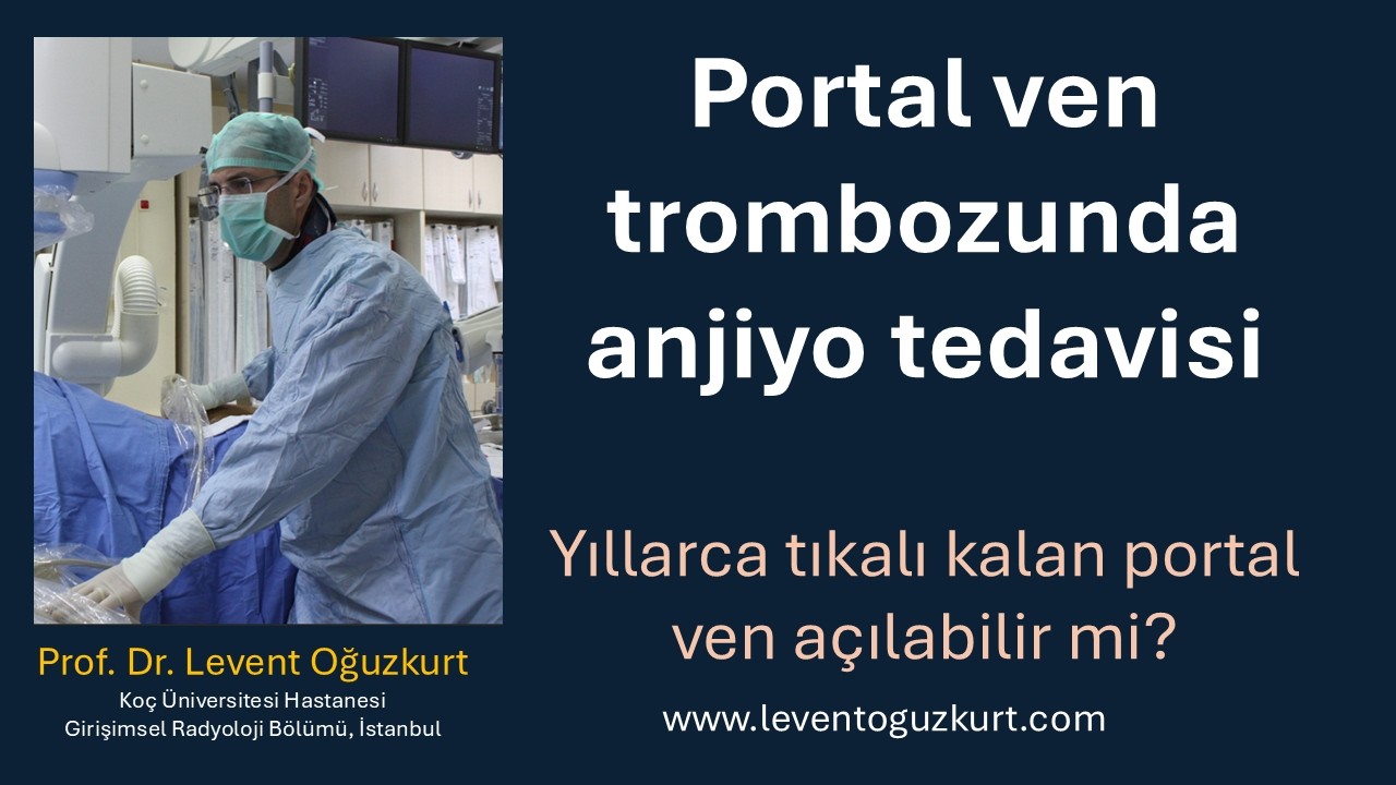Portal ven trombozu ve tedavisi