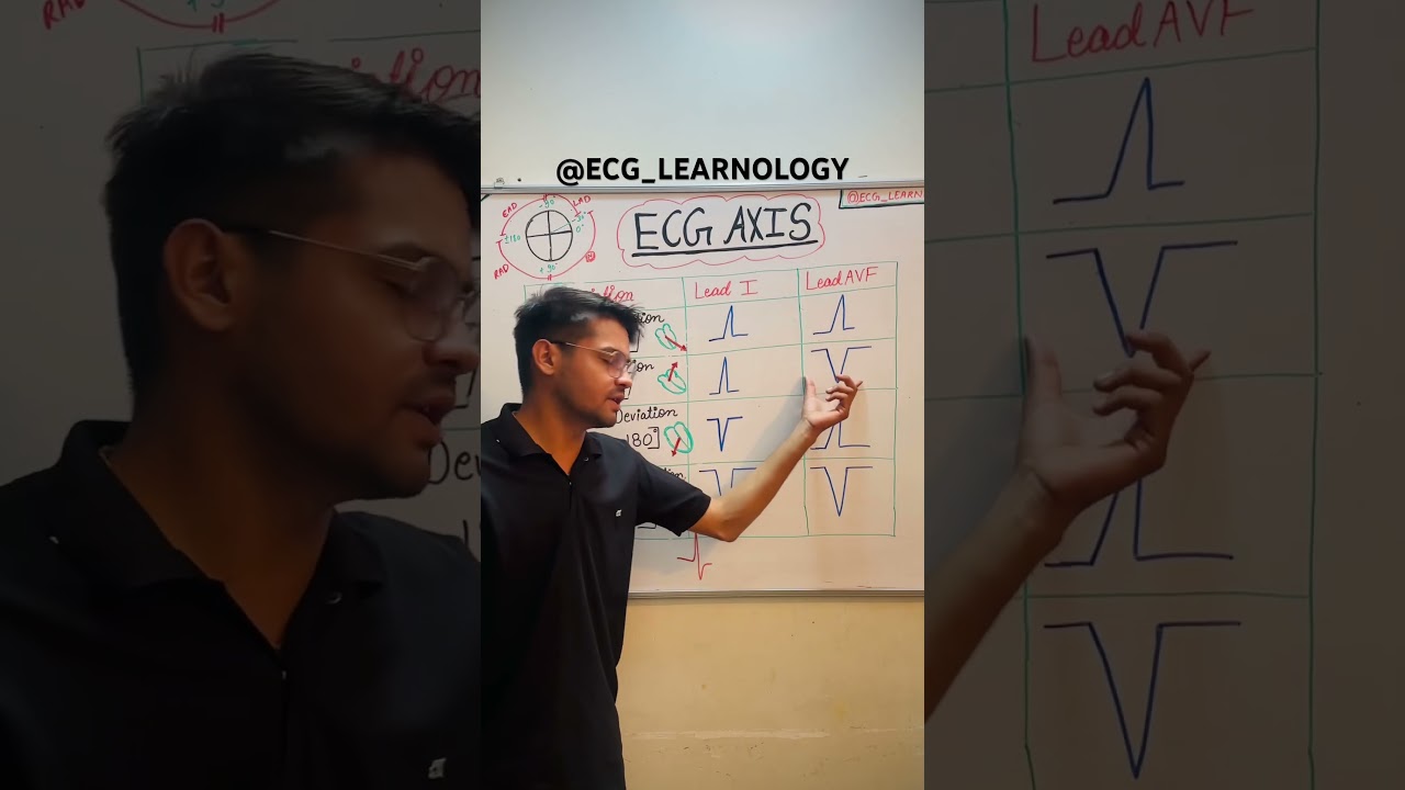 ECG Axis Explained in 60 Seconds⚡️|Quick ECG Guide#ecg #ecginterpretation #cardiology #medical #ekg