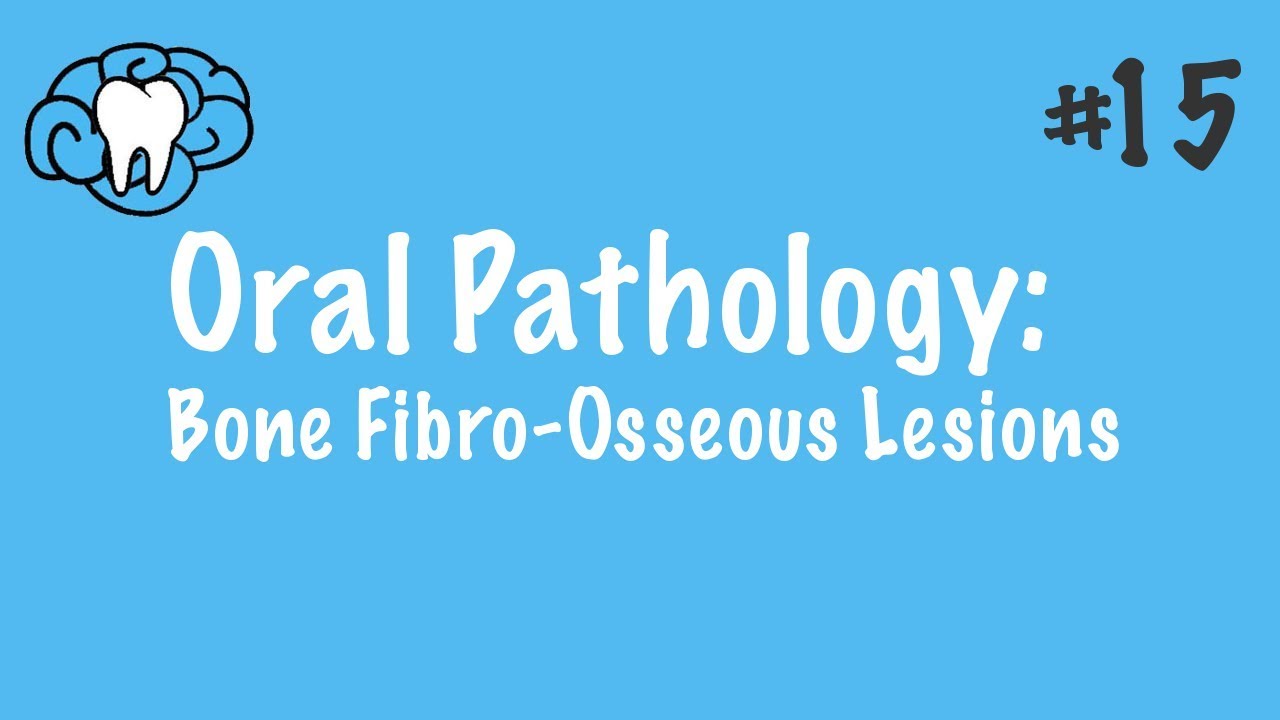 Oral Pathology | Fibro-Osseous Lesions | INBDE, ADAT