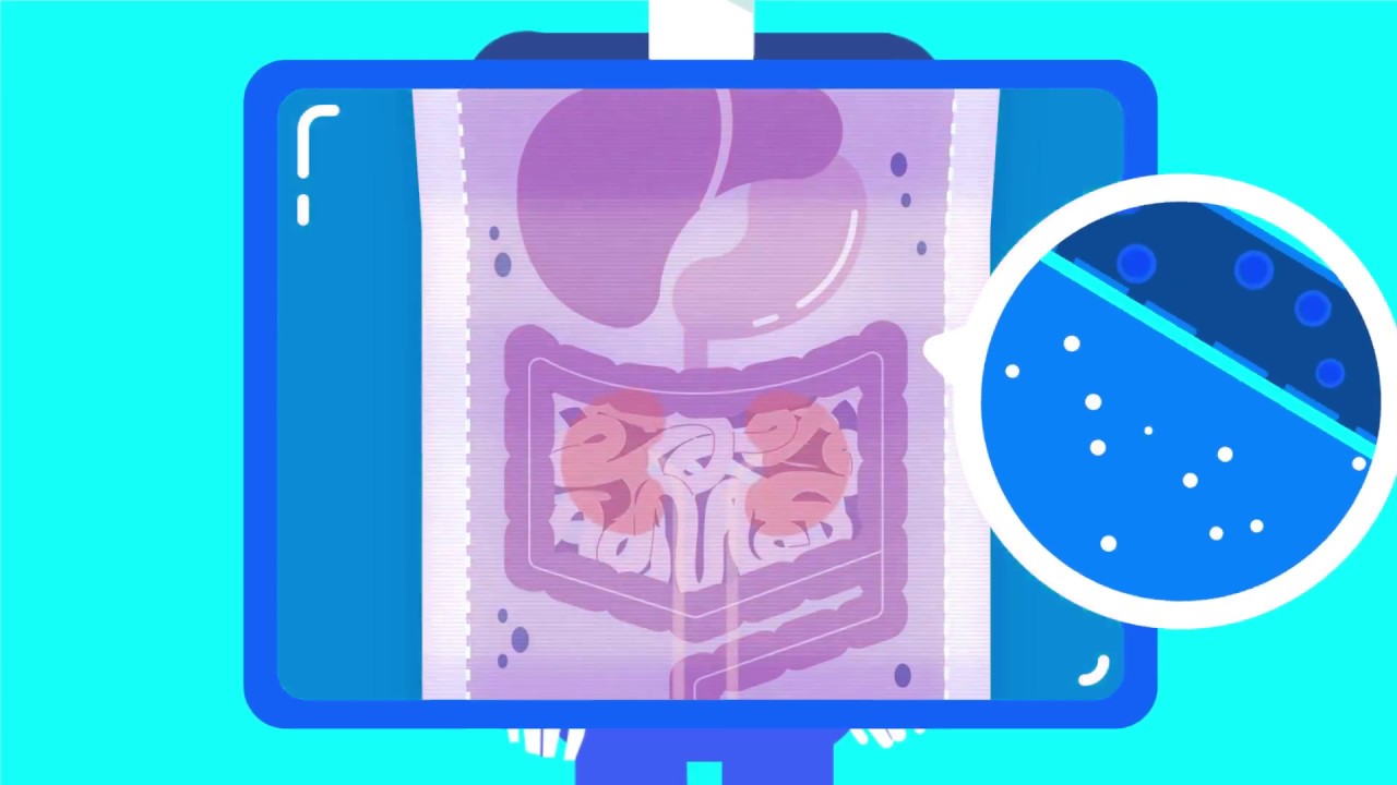 Di&aacute;lisis peritoneal