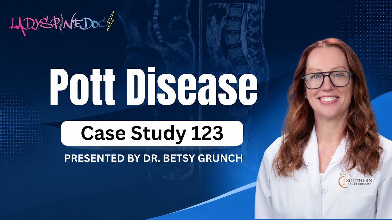 Case study 123 - Pott disease (Tuberculosis of the spine) explained by Dr. Grunch, neurosurgeon