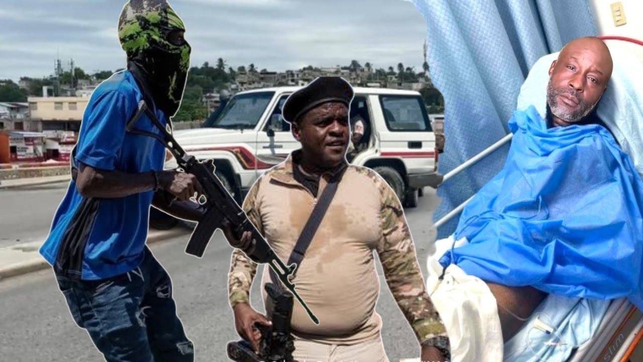KEMP&Ecirc;S PRAN BAL BATAY NAN VIV ANSANM 20 BANDI TONBE