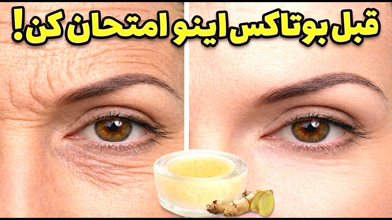 جوانسازی پیشونی بدون تزریق؟ تست کرم زنجبیل برای چروک صورت!