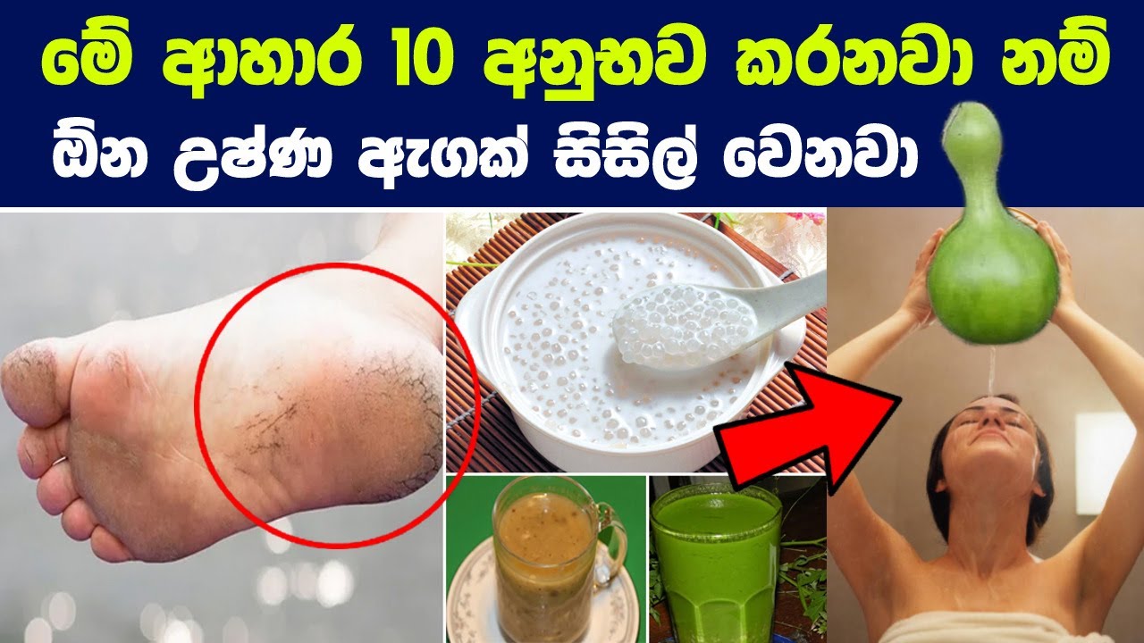 ඇග උෂ්ණය රත්පිත් රෝග සුව කර ශරීරය සිසිල් කරන ආහාර 10ක් | 10 Foods To Reduce Body Heat Naturally