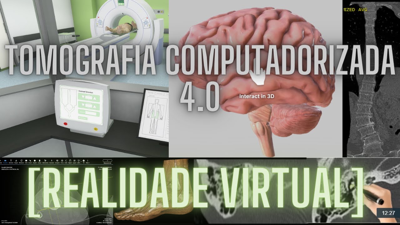 [REALIDADE VIRTUAL] APRENDA TOMOGRAFIA DE VERDADE