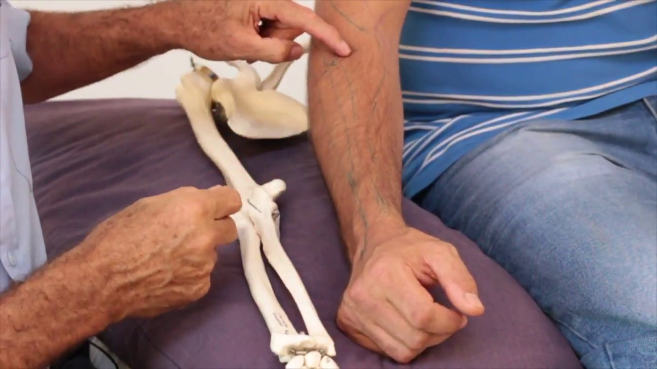 How To Treat Trigger Points - Brachioradialis (for Elbow Pain)