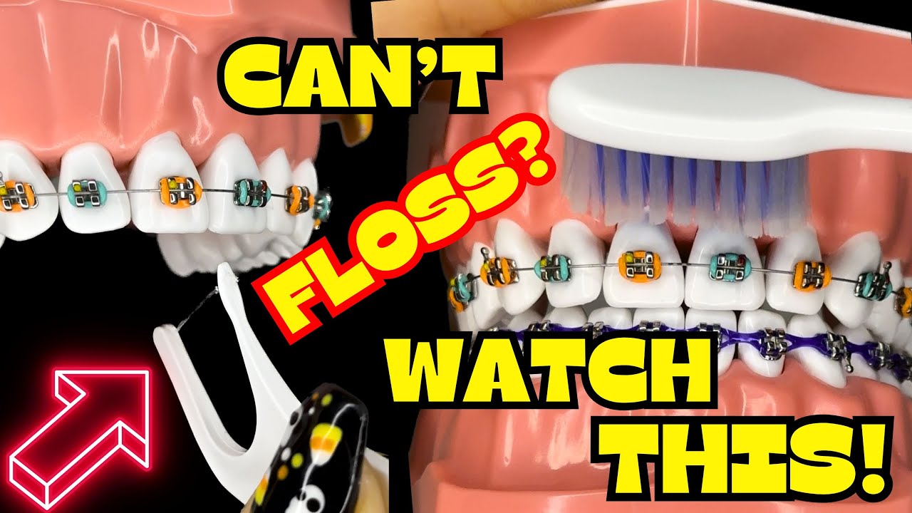 How to BRUSH and FLOSS your TEETH with BRACES ON * TUTORIAL * | BRUSHING | FLOSSING