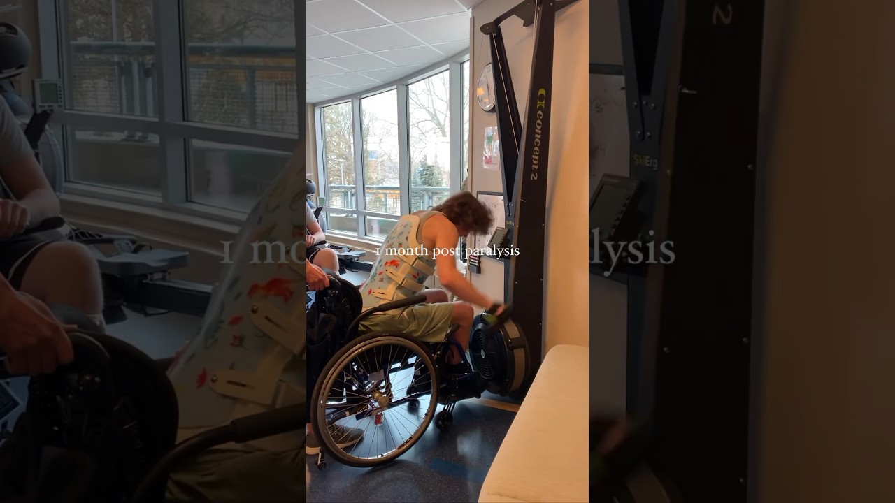 1 month vs 34 months post paralysis. Spinal cord injury recovery does not stop at 2 years out #trend