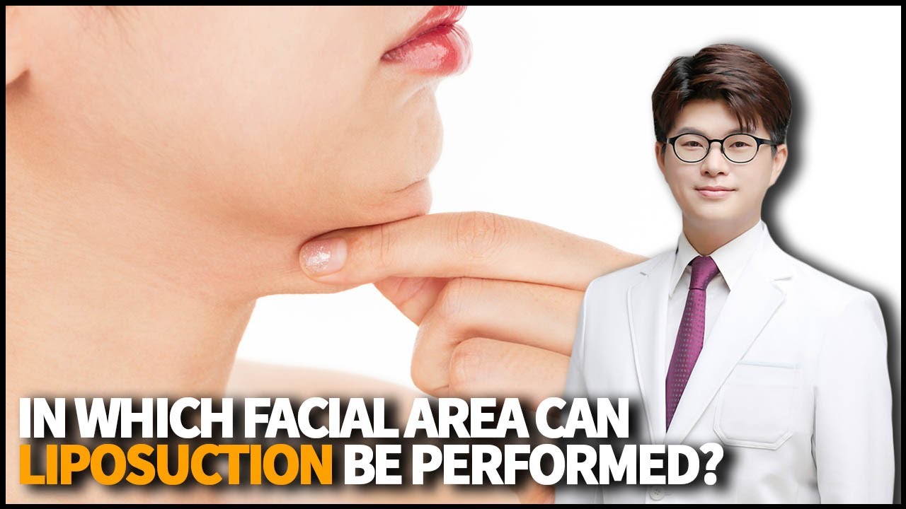 Is it possible to have Fat Grafting if someone has already done Facial Liposuction before?