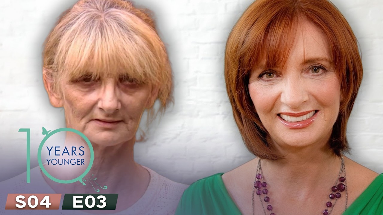 Ultimate Anti Aging | 10 Years Younger UK Season 4 Episode 3