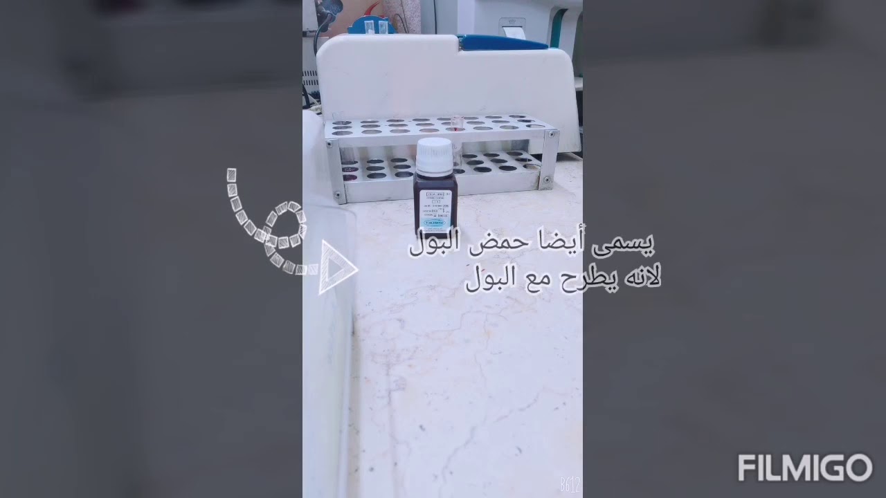 واحده واحده هنتعلم مع بعض تحليل Uric Acid او النقرص  بطريقة سهلة جدا مش هتحتاج تروح تدرب في معمل