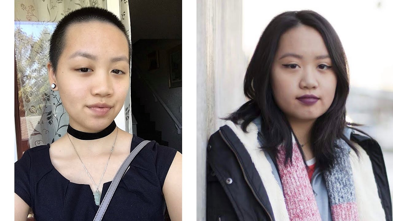 Hair Growth Time Lapse