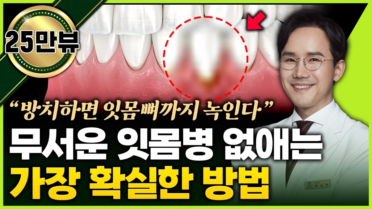 방치하면 잇몸뼈까지 녹인다. 잇몸병 없애는 가장 확실한 방법 (치주과 전문의 배승한 원장 통합)
