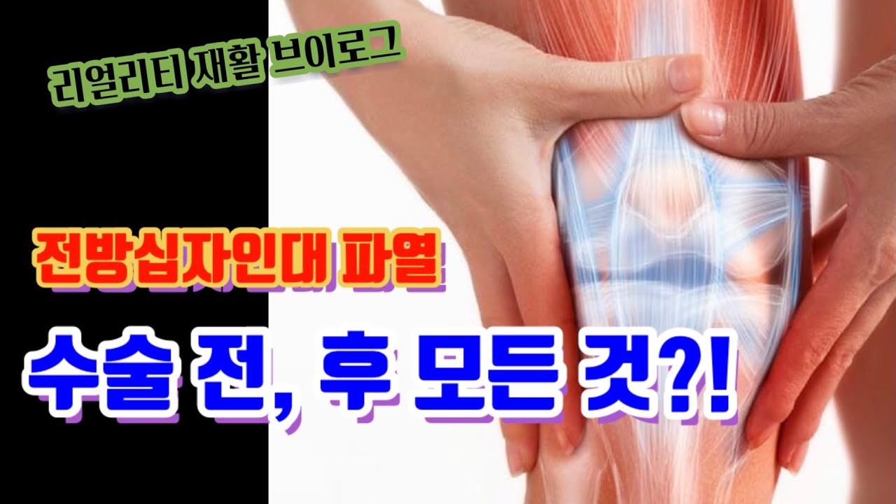 전방십자인대 파열, 연골손상 수술 전과 후 무릎재활 과정 part.1 (Knee injury, rehab, exercise)
