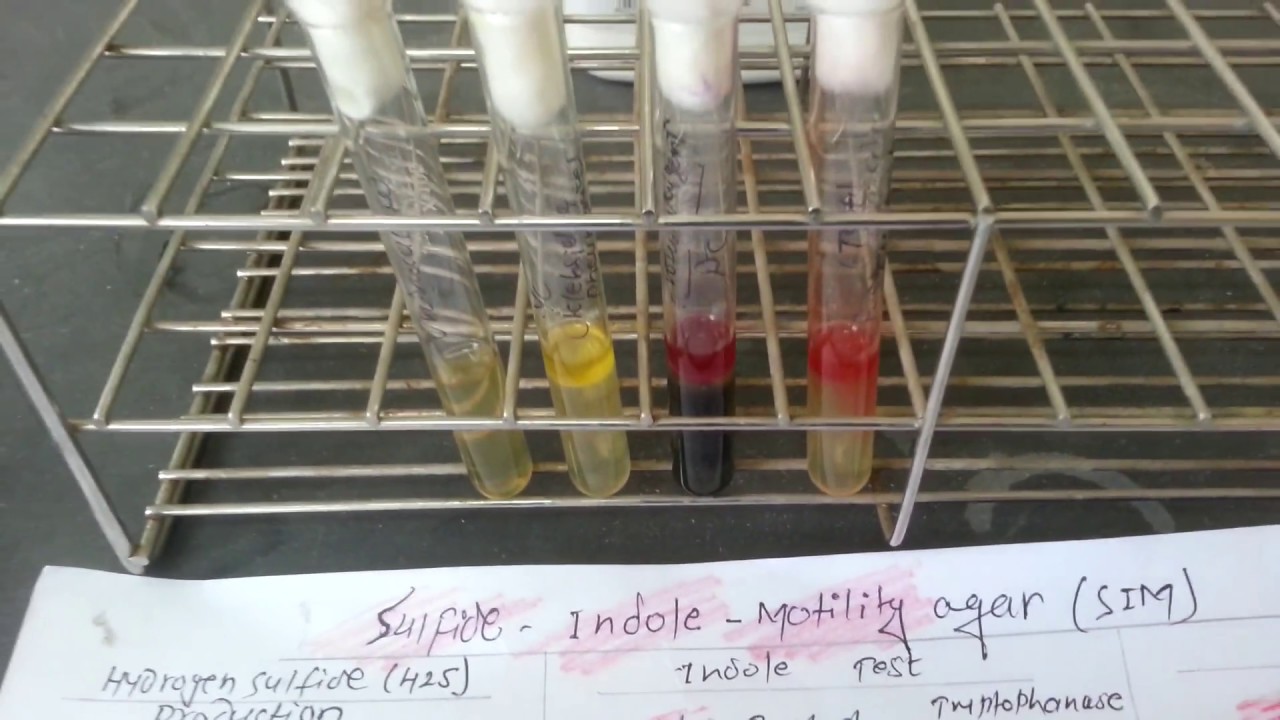 Sulfide -Indole-Motility (SIM)Test for bacteria