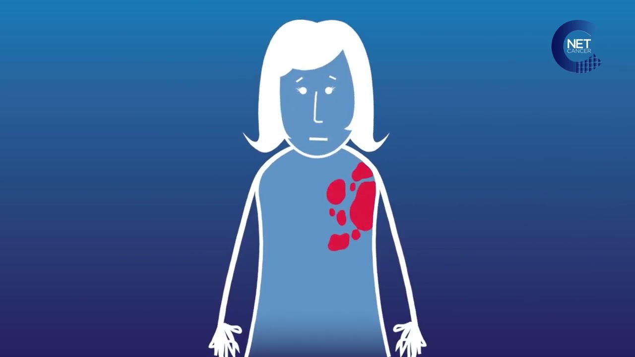Les effets indésirables les plus fréquents du Pertuzumab