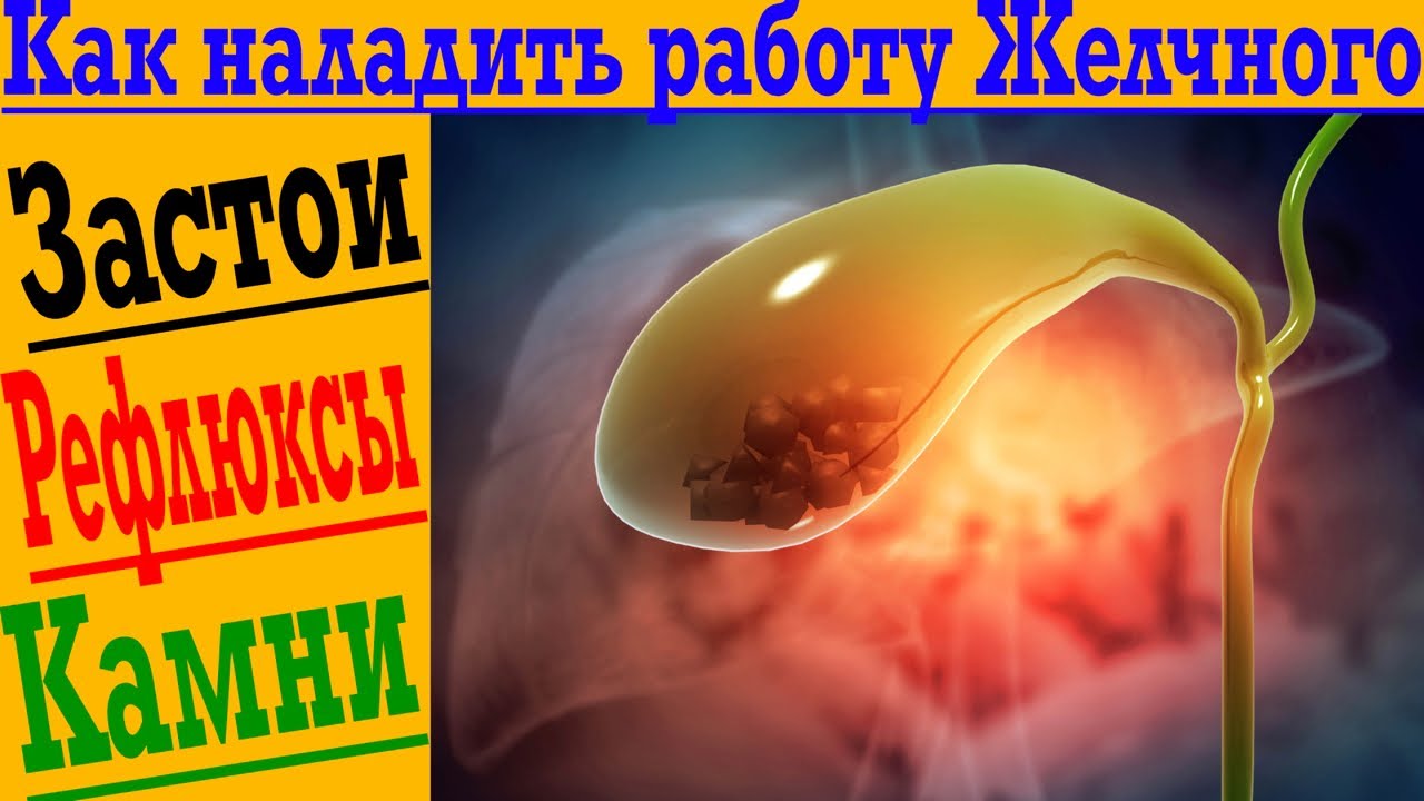 Как наладить работу Желчного пузыря! Рефлюксы, застой, камни и многое другое!