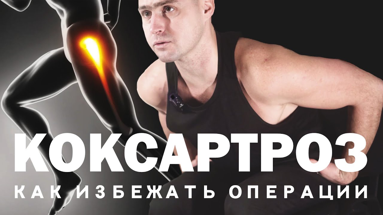 КОКСАРТРОЗ. ИЗБЕЖАТЬ ОПЕРАЦИЮ. УПРАЖНЕНИЯ. ПАТАЛАХ АРТУР