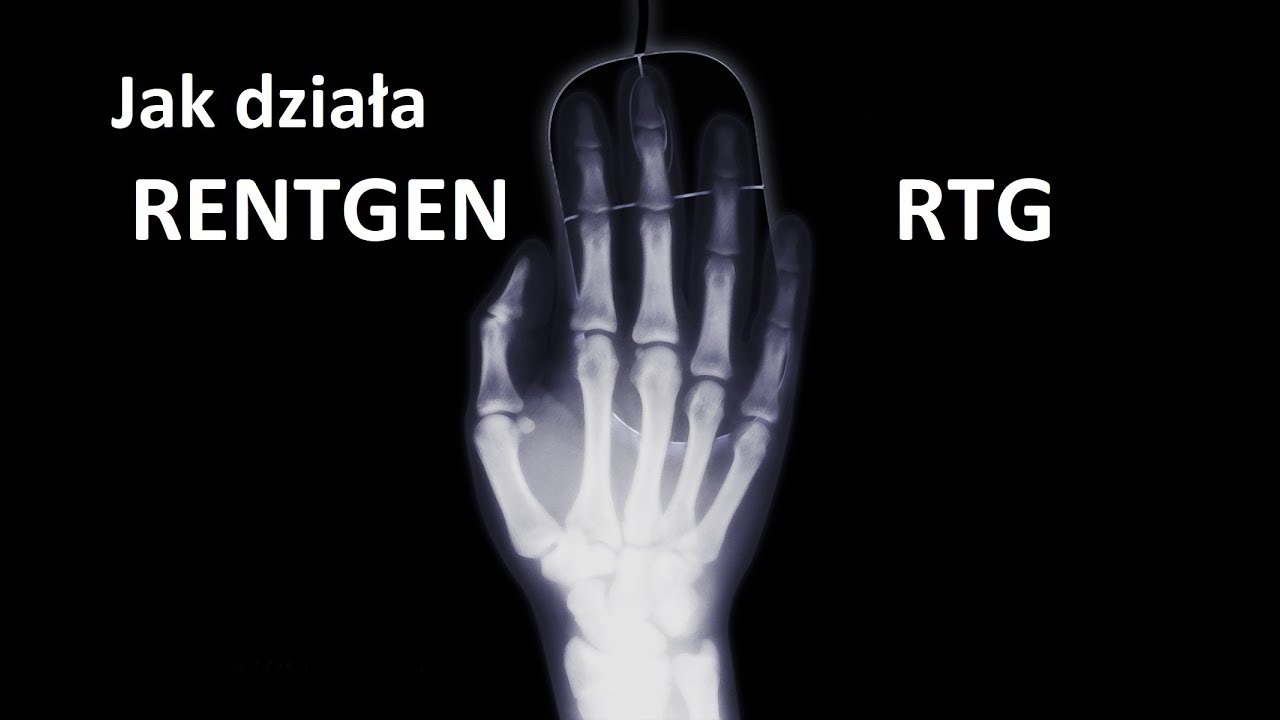 Jak działa RENTGEN - RTG