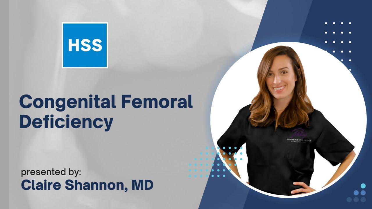 Congenital Femoral Deficiency - Claire Shannon, MD