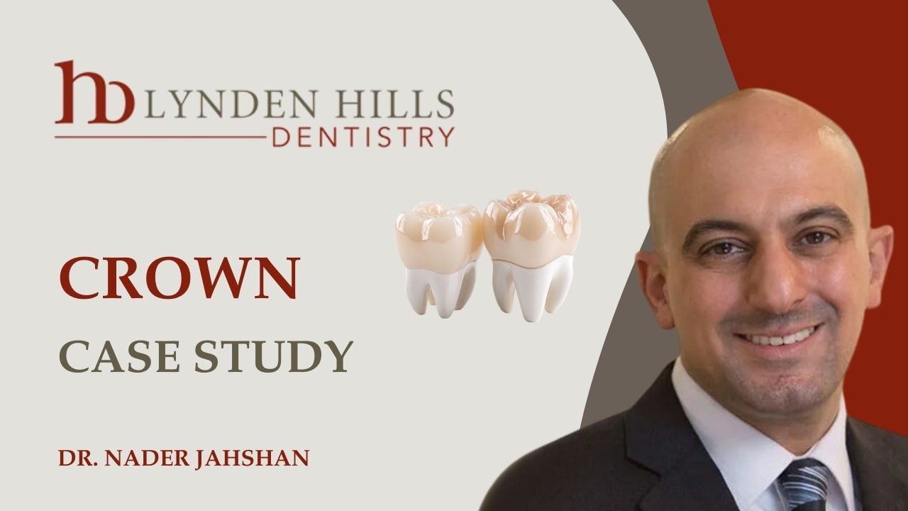 Lynden Hills Dentistry - Crown - Case Study