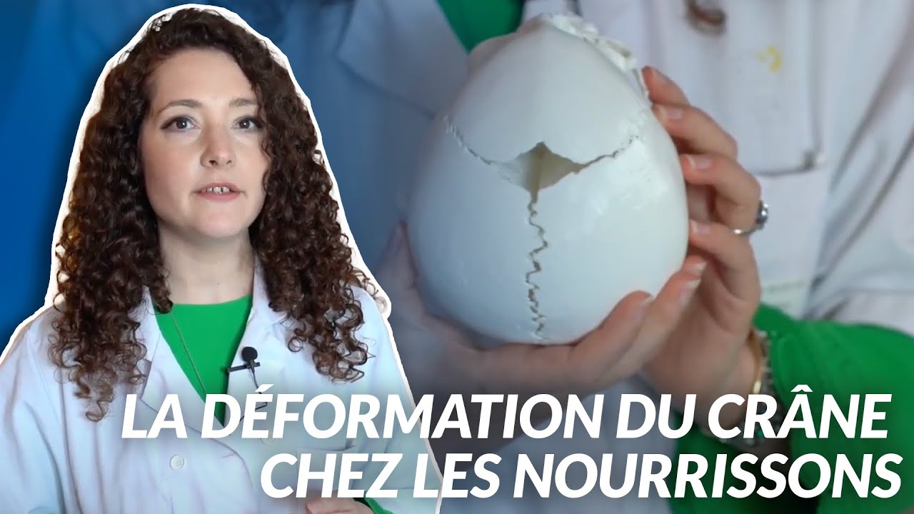 La déformation du crâne chez les nourrissons