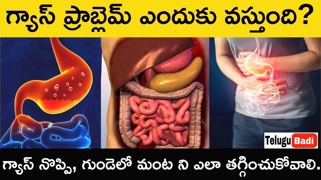 Gas Problem Explained Telugu | Gastric Causes, Symptoms, Treatment in Telugu| How to Cure Gas Pain