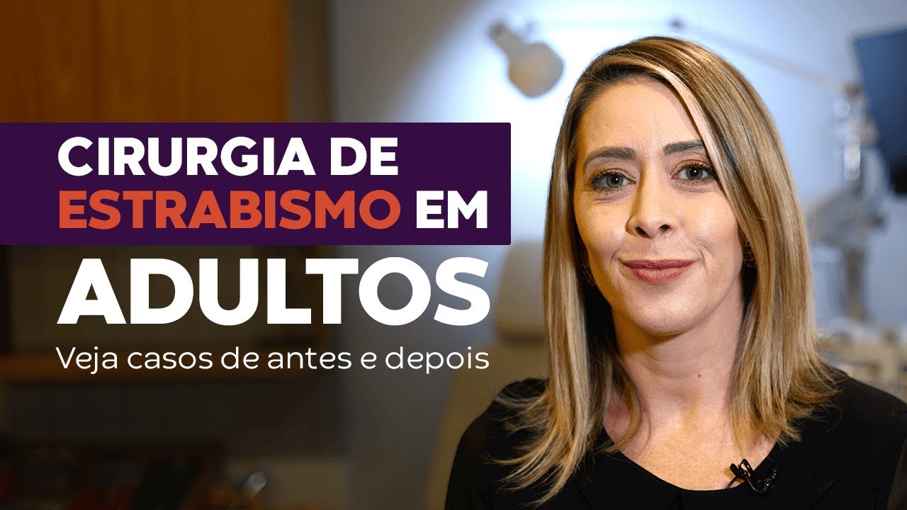 Cirurgia de estrabismo em adultos funciona? Veja antes e depois de casos reais