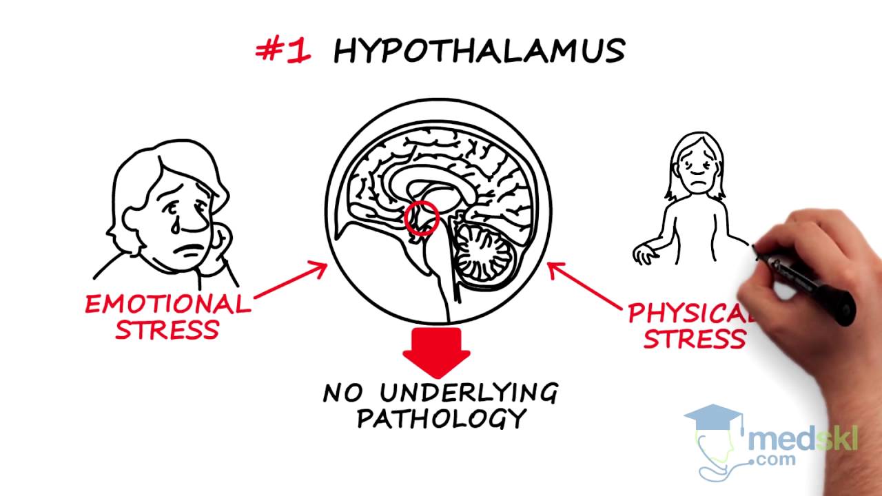 Obstetrics and Gynecology &ndash; Secondary Amenorrhea: By Paul Davies M.D.