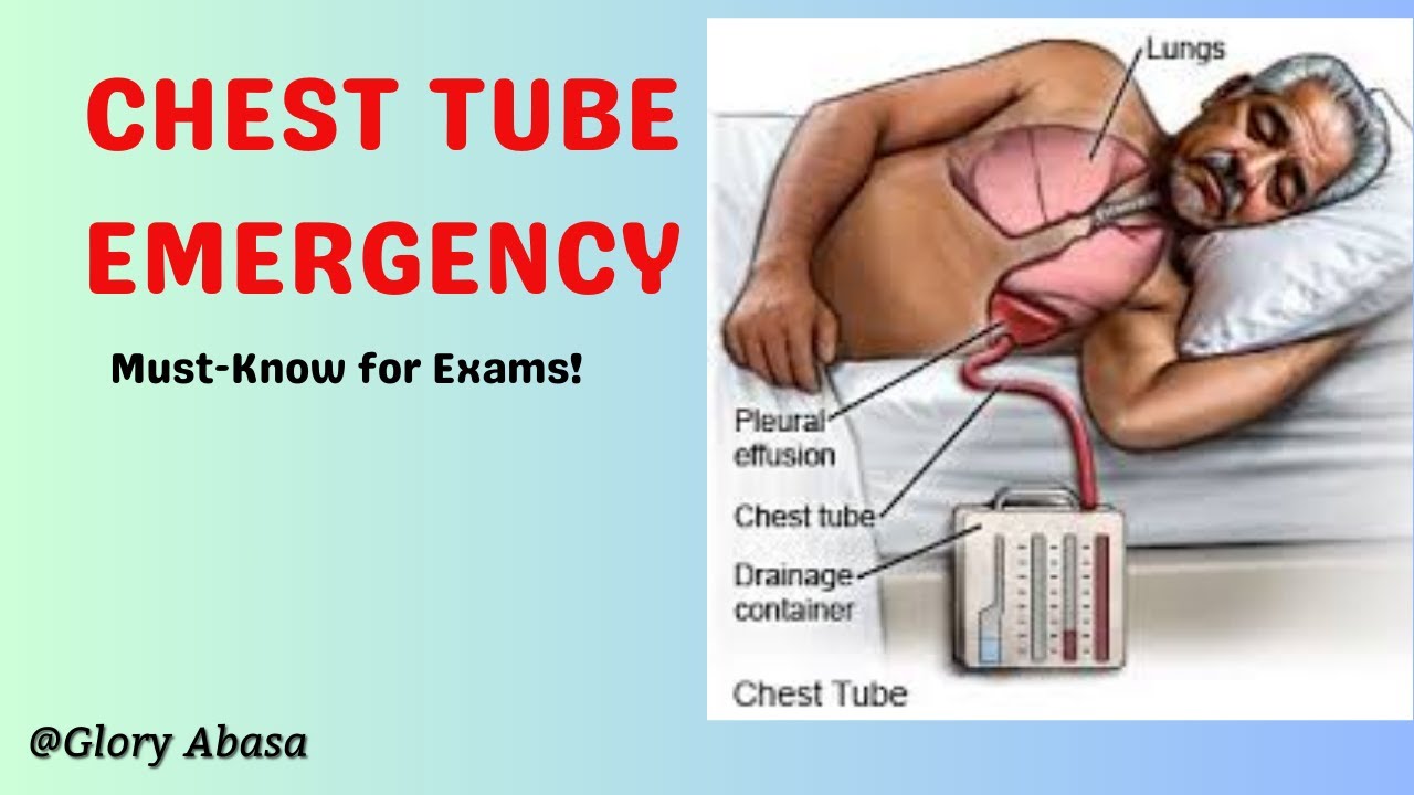 Master And Solve Common Chest Tube question Quickly