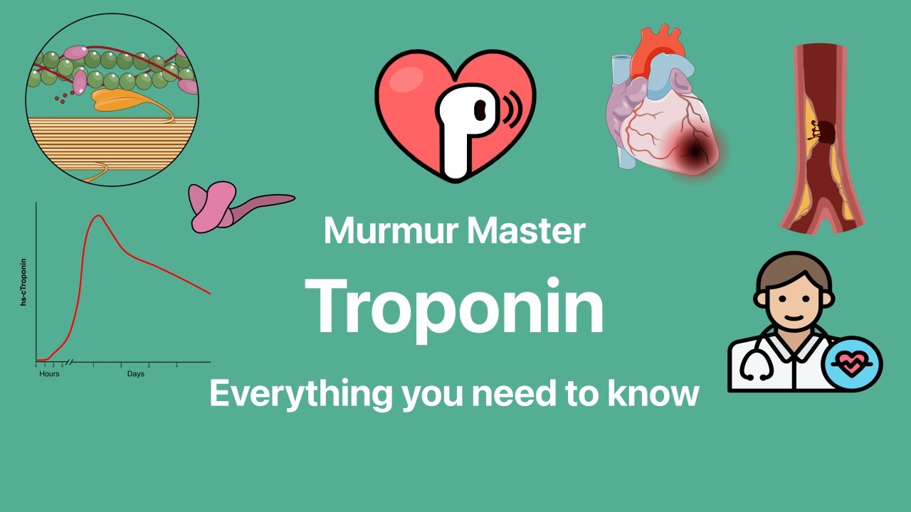 Troponin (myocardial injury, type 1 MI, type II MI)