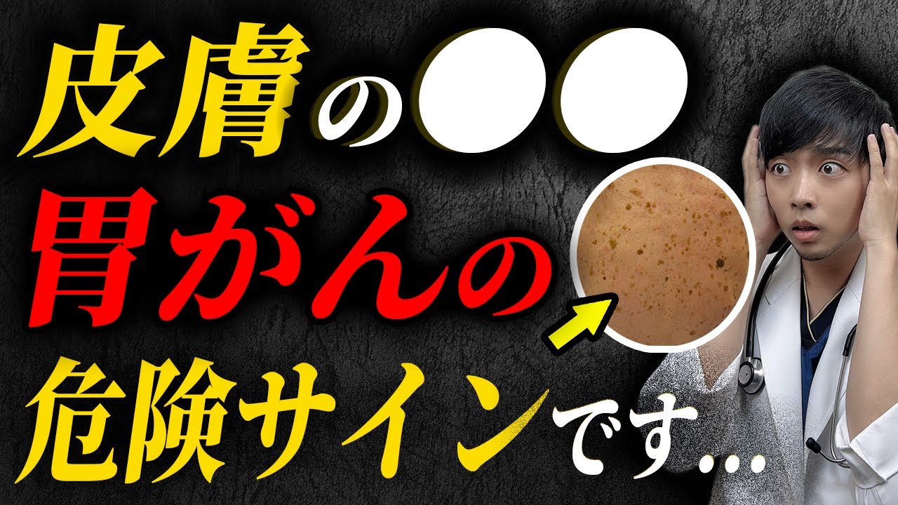 【危険】放置すると後悔する『胃がん』の意外な５つの症状【内視鏡医が解説】