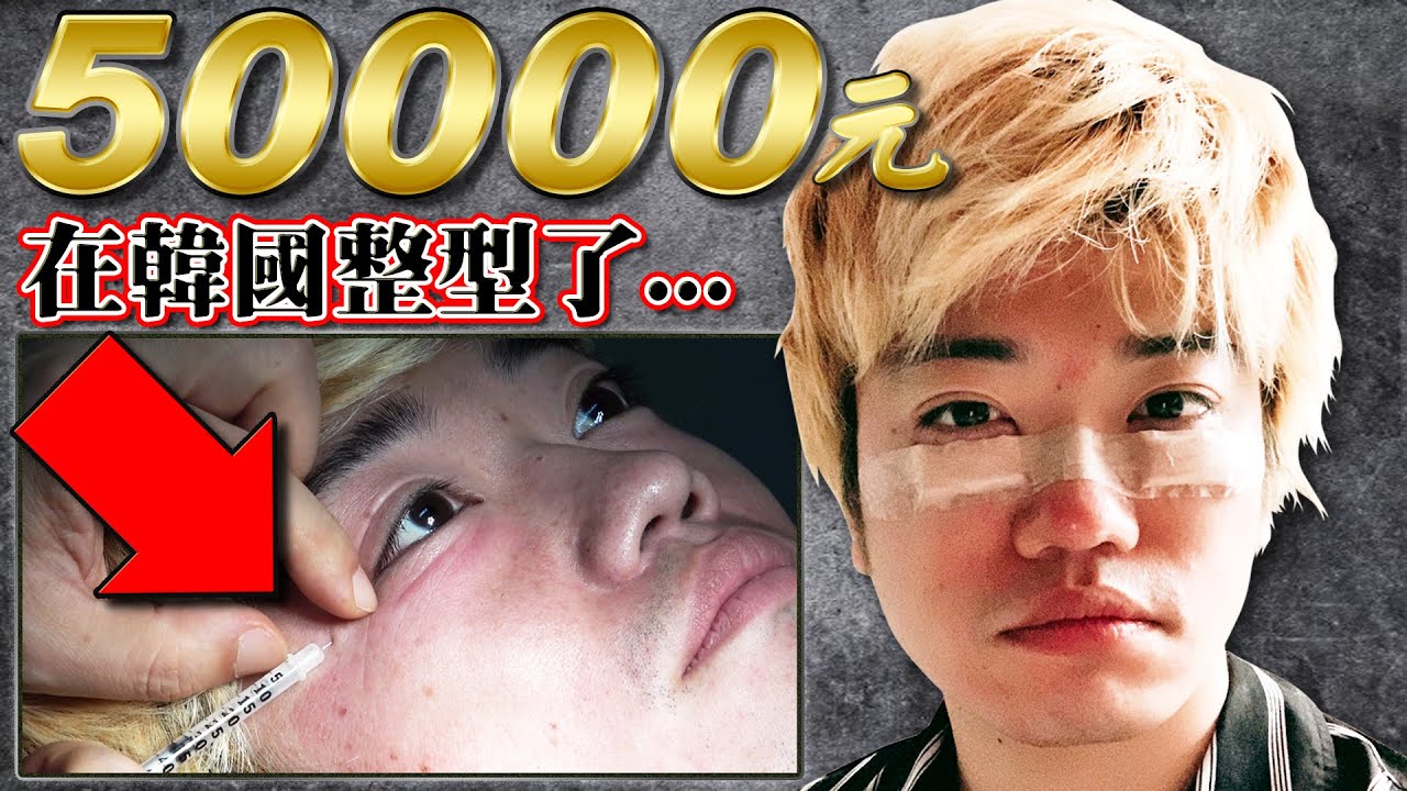 Jun醬在韓國花50000元動刀整形了！？兩週後臉的變化也太誇張了吧...