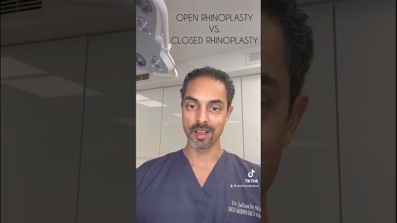 Open Vs. Closed Rhinoplasty - How to get the perfect nose! #rhinoplasty #nosejob