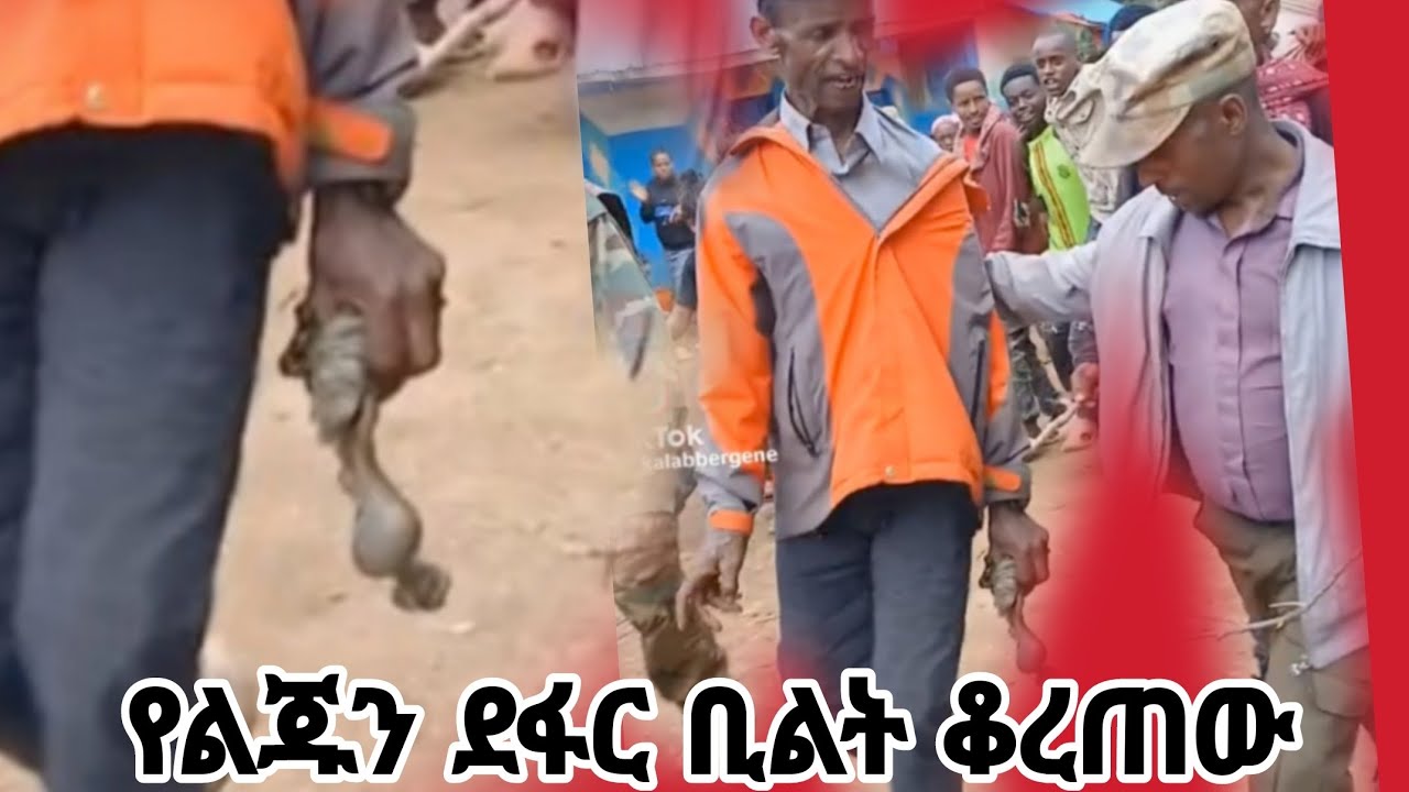 ጀግናው🔴 የወላይታው  🔴አባት🔴🔴