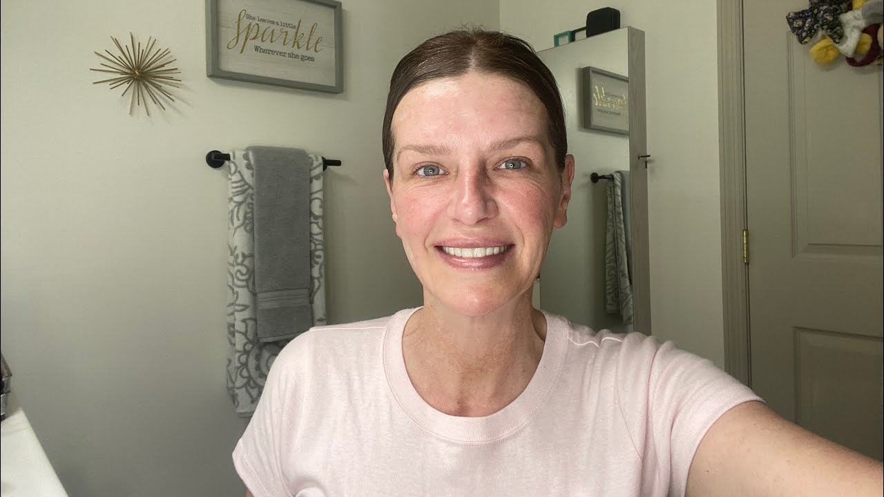 Dentures or Implants | Why I decided to get dentures instead of implants | Dentures
