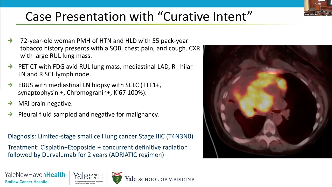 Small Cell Lung Cancer: Updates, Progress, and Promise of 'Targeted Therapy' | Dr. Anne Chiang