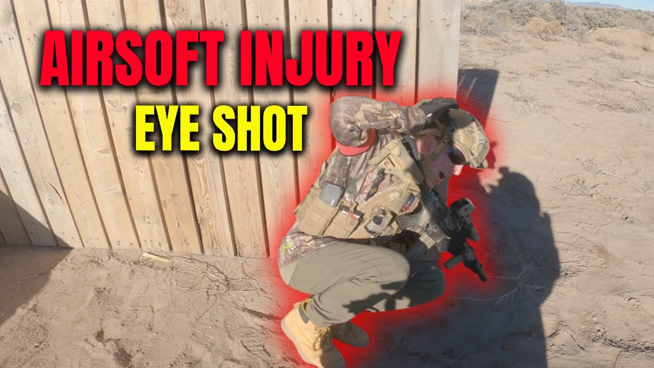 Airsofter Shot in the Eye — Even With Eye Protection