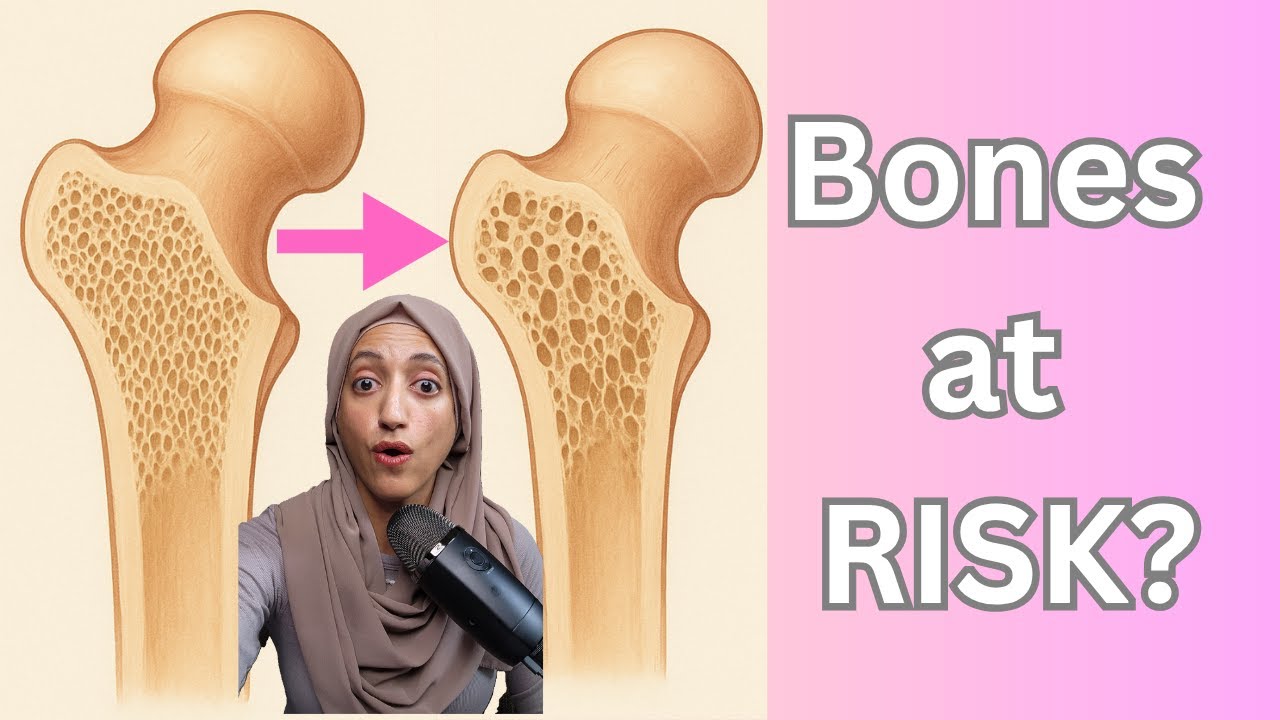 Osteoporosis Explained: Who’s at Risk & What to Do