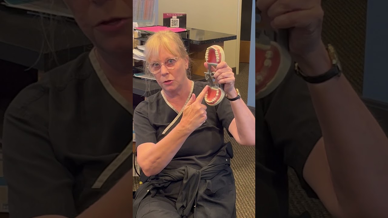 Edentulous Digital Scanning | PrimeScan Edentulous Scanning Technique