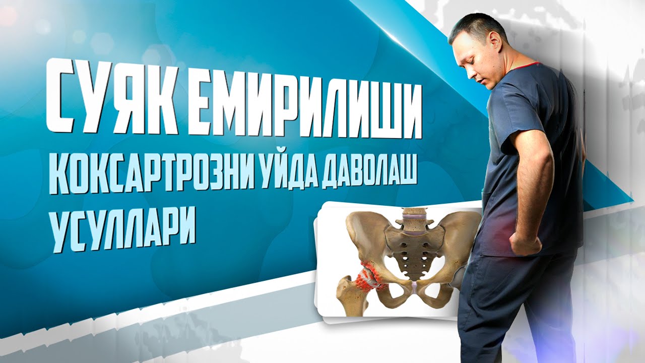Коксартрозни уйда даволанг!
