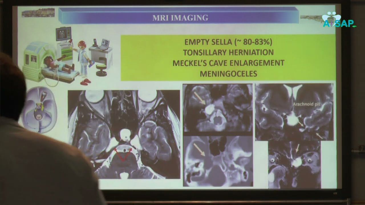 Diagnostica neuroradiologica, Luigi Cirillo (Bologna)