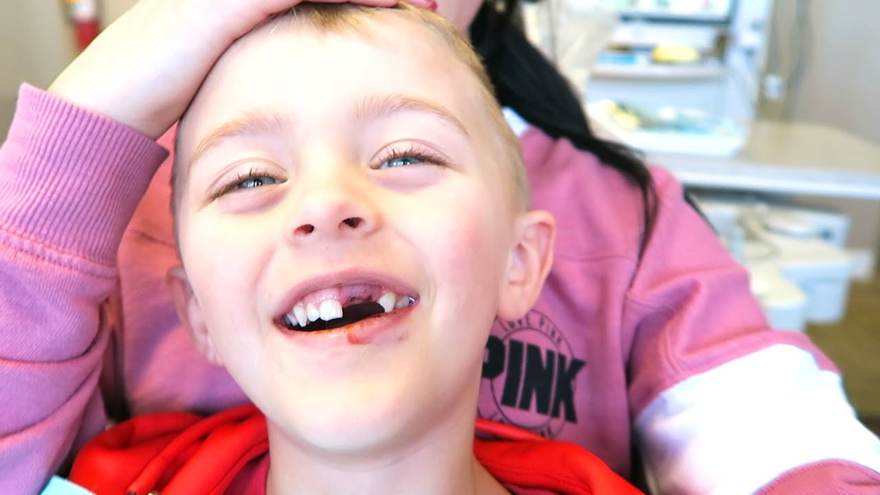 HE KNOCKED HIS TEETH OUT!!
